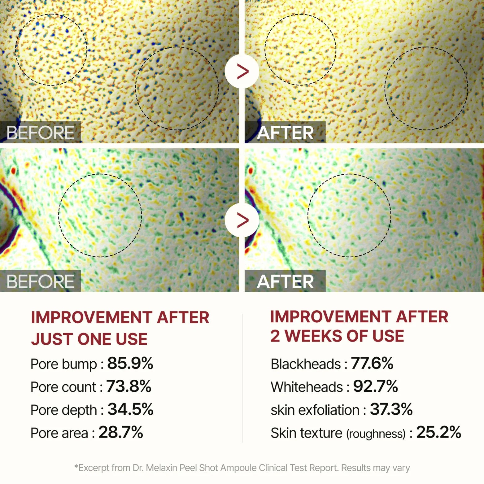 Dr.Melaxin Peel Shot