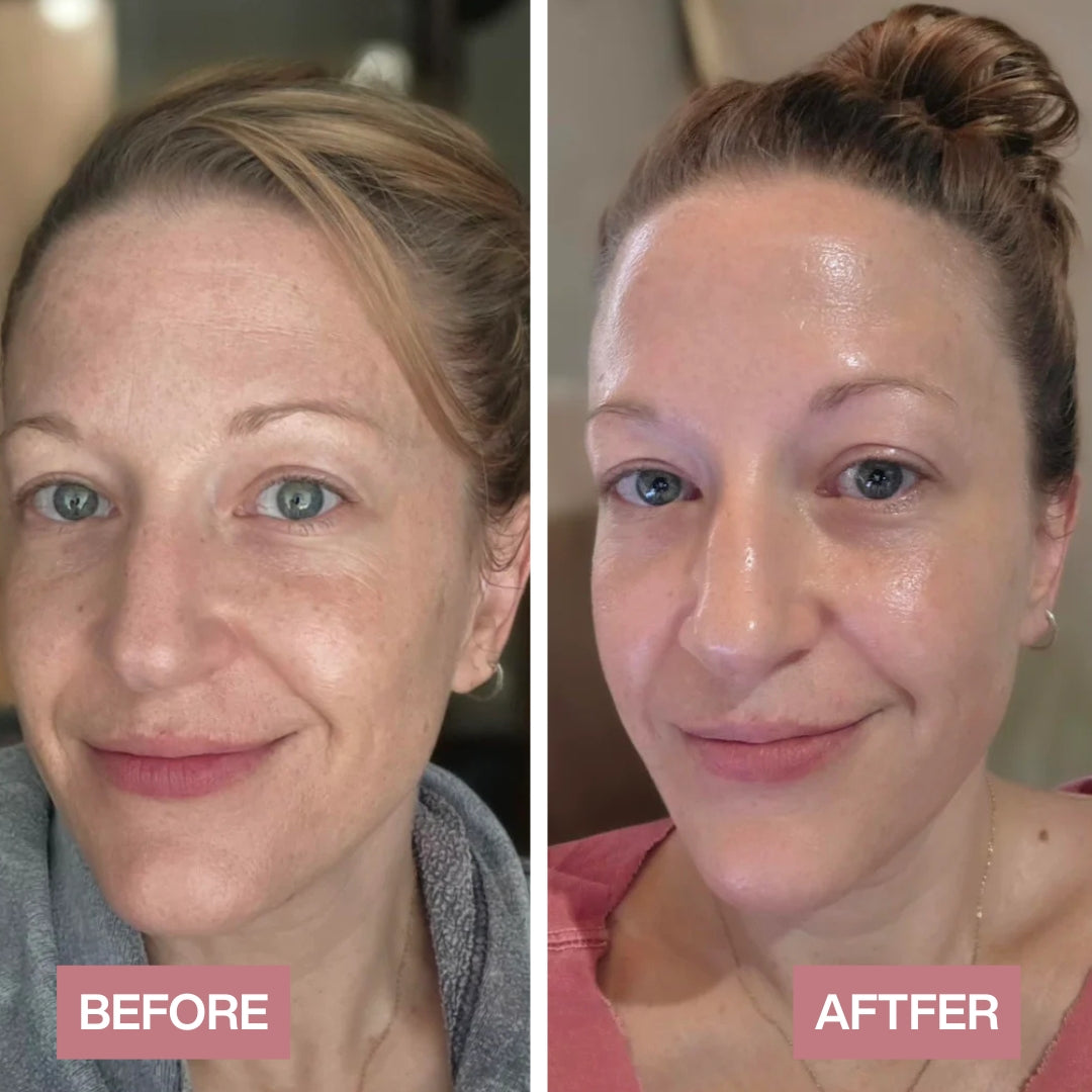 Dr.Melaxin Peel Shot